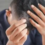 Perché perdiamo i capelli? Come stimolarne la ricrescita?